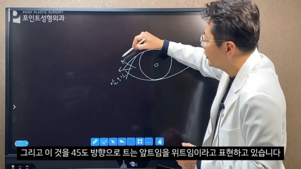 원장이 화면의 눈 그림에서 눈머리 쪽 절개 방향을 그리는 모습